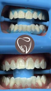 14494556-6309-47bb-a1a9-1aff5fa63fc0