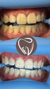 aef4f300-f5d0-4cf0-9de1-e66cbd74f626